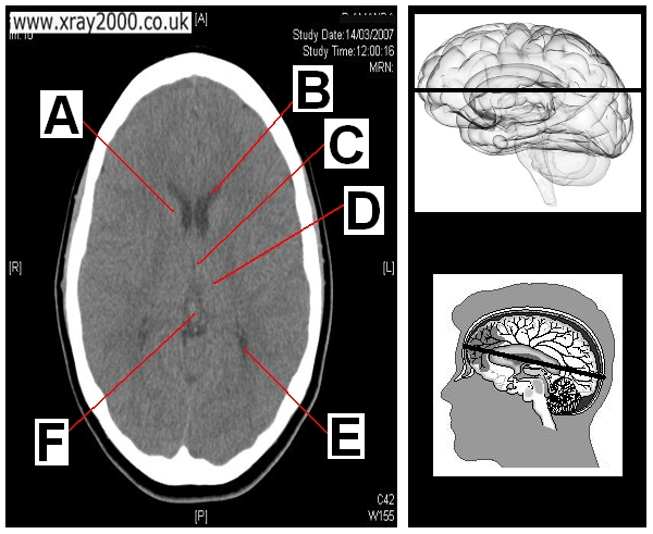 AXIAL SECTION 5.JPG